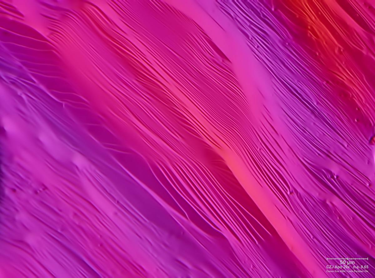 vorticella?